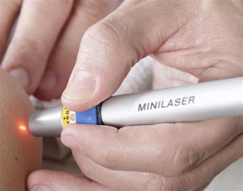 The Effectiveness of Laser Acupuncture for Treatment of .